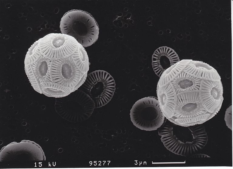 Emiliania-huxleyi-Zellen in einer elektronenmikroskopischen Aufnahme. Foto: Lennart Bach, GEOMAR (CC BY 4.0)