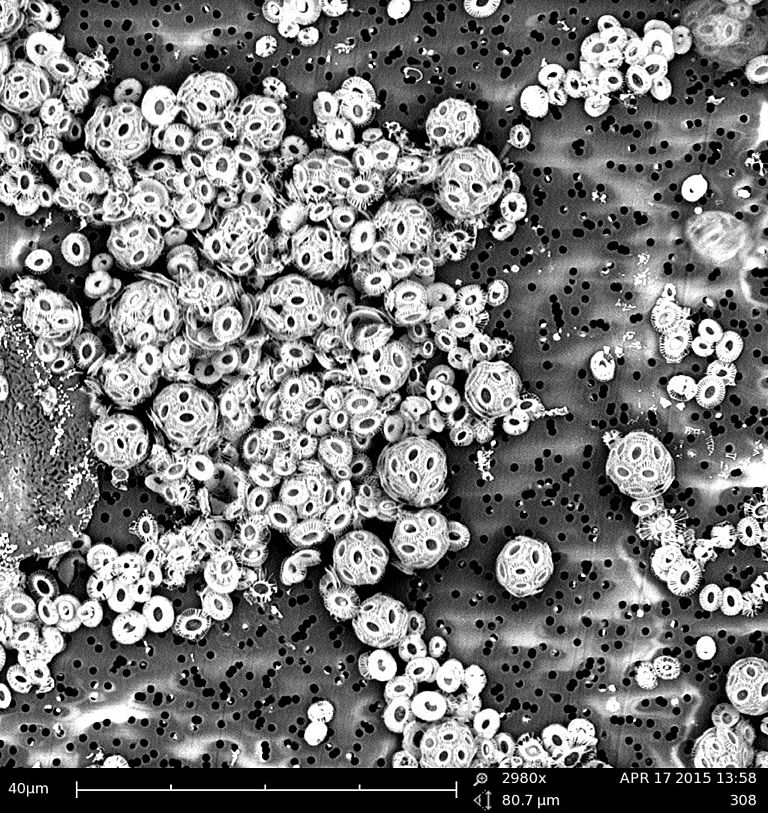 Mikroskopische Aufnahme der Kalkalge Emiliania huxleyi. Foto: Luisa Listmann, GEOMAR
