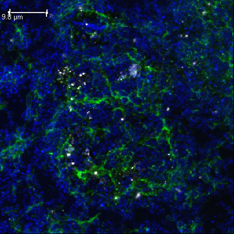 Das Bild zeigt stark vergrößert den Biofilm einer sulfatreduzierenden Bakterienart. Die Bakterien sind in blau zu sehen, dazwischen hat sich ein Biofilm ausgebildet, in dem in weiß ausgefallene Dolomitkristalle zu sehen sind. Das Bild wurde aufgenommen mit einem konfokalen Laser-Scanning-Mikroskop (ETH Zürich/Uni Zürich)