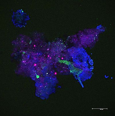 Particle aggregates harbor rich microbial communities, shown here by confocal laser scanning microscopy. Blue: Polysaccharide gel matrix of the aggregate, green: bacteria, pink/red: algal cells. Picture: Jan Michels