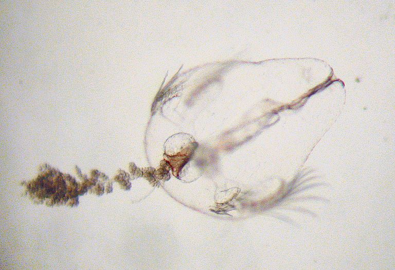 Halbierte Rippenquallenlarve unter dem Mikroskop. Foto: K. Bading