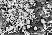 Mikroskopische Aufnahme der Kalkalge Emiliania huxleyi. Foto: Luisa Listmann, GEOMAR