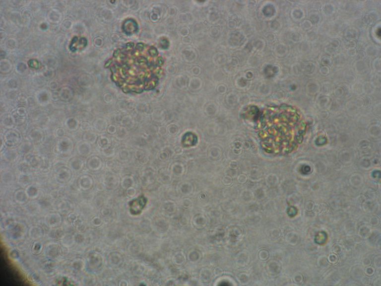 Die Alge Vicicitus globosus unter einem Mikroskop. Foto: Ulf Riebesell/GEOMAR (CC BY 4.0)