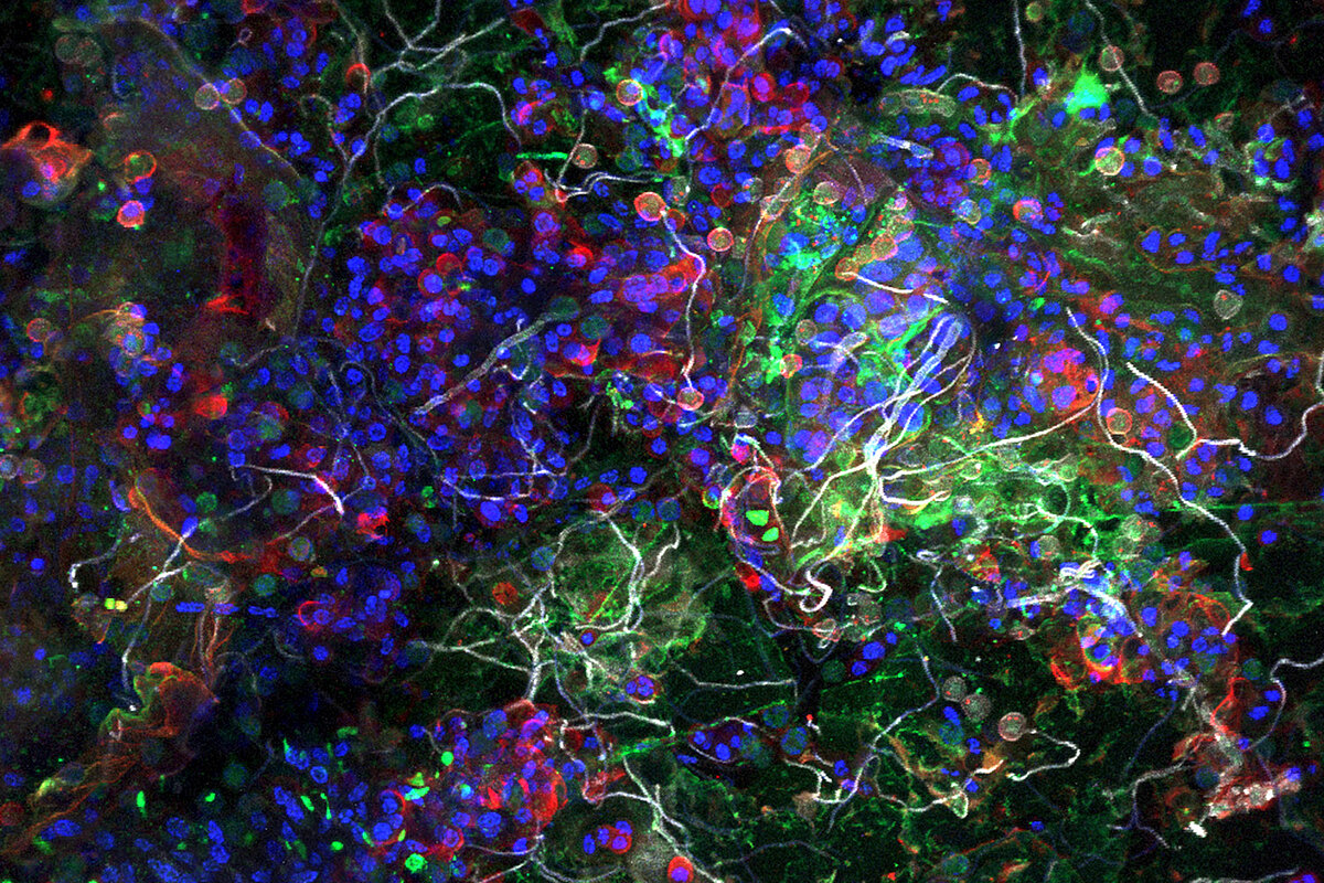 Confocal laser scanning microscopy image
