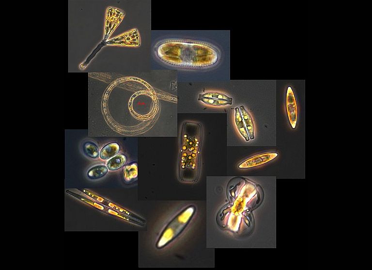 Diese am Meeresboden lebenden, mikroskopisch kleinen Algen waren die Untersuchungsgegenstände der ersten Masterarbeit an der Mathematisch-Naturwissenschaftlichen Fakultät der Christian-Albrechts-Universität zu Kiel. Fotos und Collage: Lena Eggers