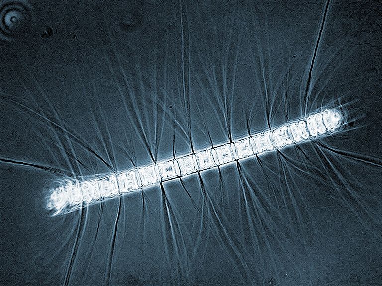 Der Favorit: Chaetoceros, Planktontyp: Kieselalge. Da Ihre Schale aus Silikat besteht, ist diese Diatomeen-Art  eigentlich unempfindlich gegen die zunehmende Ozeanversauerung. Foto: Luisa Listmann, GEOMAR