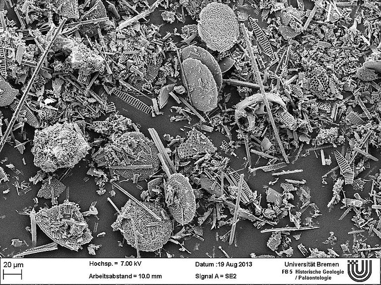 Mariner Diatomenschlamm unter einem Rasterelektronenmikroskop. Foto: Gauvain Wiemer und Ricarda Dziadec, MARUM