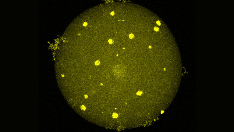 Microscopic image: showing a green ball with bright fluorescent dots on it