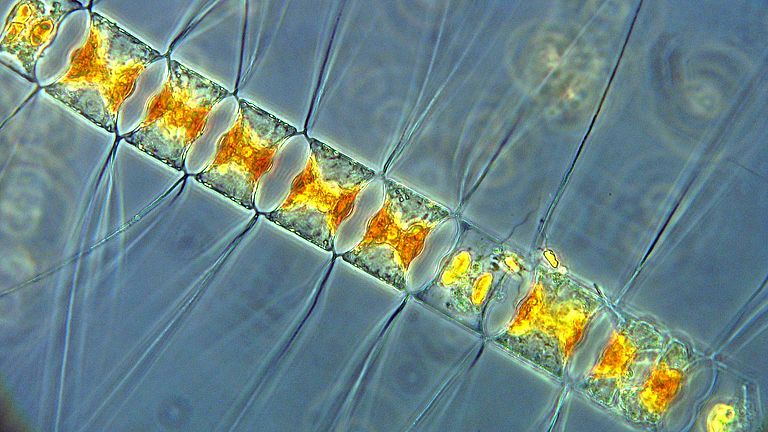 Diatom Chaetoceros diadema