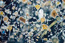 Die Vielfalt des Phytoplanktons erkennt man nur unter dem Mikroskop.  Foto: Annegret Stuhr / GEOMAR