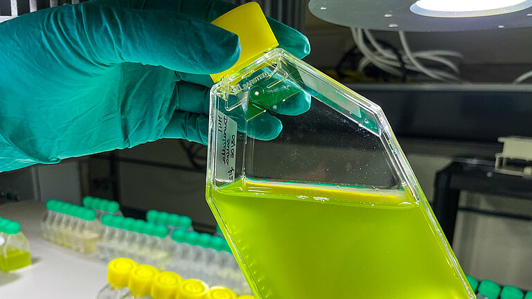 Hände in grünen Handschuhen halten eine kleine Flasche mit hellgrüner Flüssigkeit