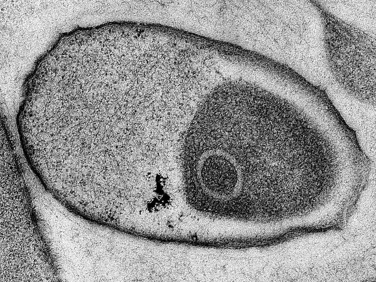 Transmission electron microscope image of an unknown bacterium that lives exclusively in marine sponges. Sponge symbionts cannot yet be cultivated and can only be given a provisional name according to the current codex. Photo: Dr. Martin Jahn (GEOMAR)