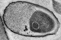 Transmissions-Elektronenmikroskopische Aufnahme eines unbekannten Bakteriums, welches ausschließlich in Meeresschwämmen lebt. Schwammsymbionten sind bisher nicht kultivierbar und können nach dem bisherigen Kodex nur mit einem vorläufigen Namen versehen werden. Foto: Dr. Martin Jahn (GEOMAR)