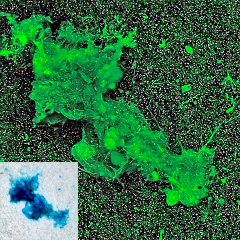 Gel particle formed in water from the Kiel Fjord, visualized using confocal laser scan-ning microscopy (large micrograph) and conventional bright-field microscopy (small micrograph). The sugar compounds in the gel particle were stained with a blue dye (small micrograph) and a fluorescent dye (large micrograph, green). The length of the edge of the large image corresponds to 160 µm. Photo: J. Michels, GEOMAR