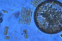 Phytoplankton aus dem Südlichen Ozean. Foto: Jeff McQuaid.