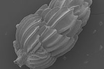 Electron-micrograph of Uvigerina peregrina