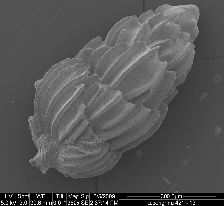 Electron-micrograph of Uvigerina peregrina