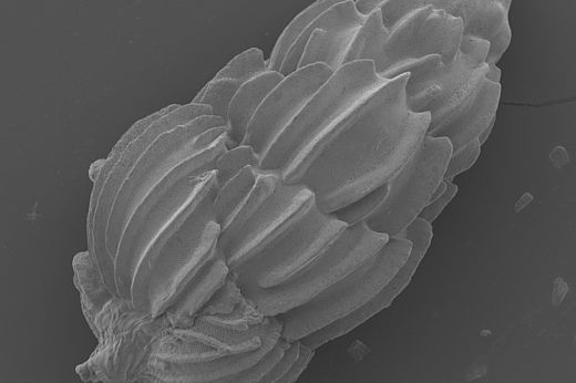 Elektronenmikroskopaufnahme von Uvigerina peregrina