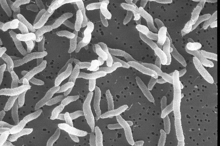 Kiloniella laminariae unter einem Rasterelektronenmikroskop. Die einzelnen Bakterien haben einen Durchmesser von etwa einem halben Mikrometer. Aufnahme: Rolf Schmaljohann, KiWiZ